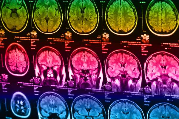 Scan of human brain
