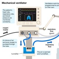 Mechanical ventilation